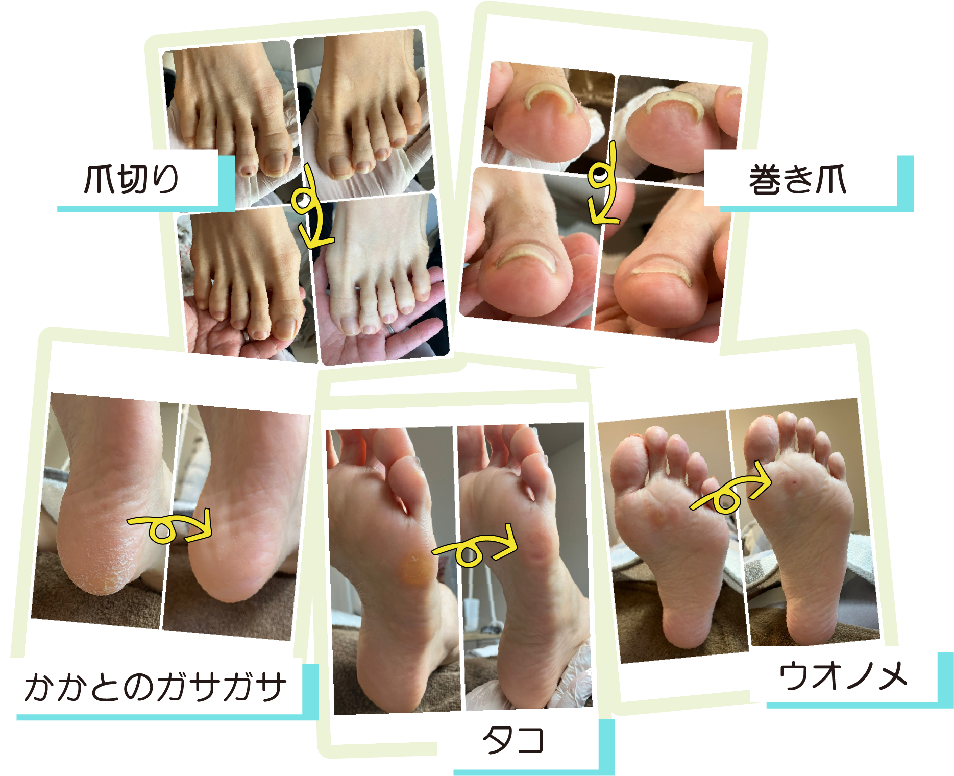 改善例